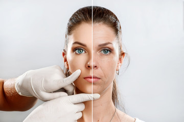 Preparando-se para um Lifting Facial